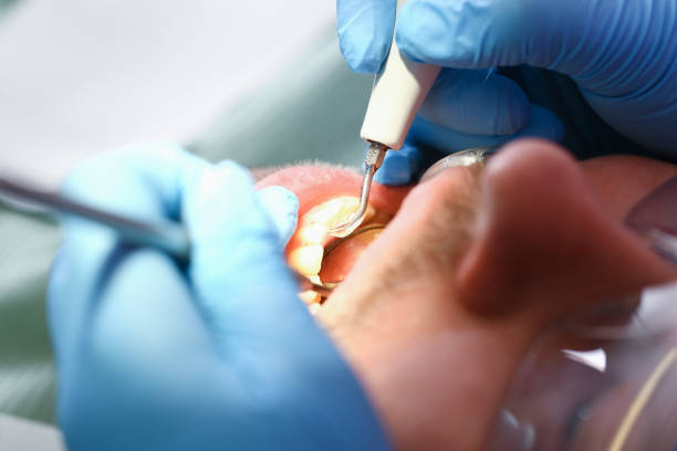 Best Emergency Dentist for Special Needs Patients in South Bend, IN
