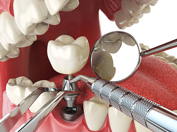 Best Emergency Cosmetic Dentistry in South Bend, IN